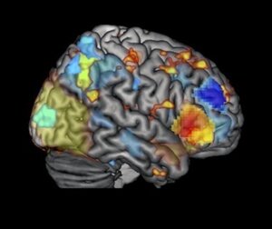 image showing activation from all three imaging methods